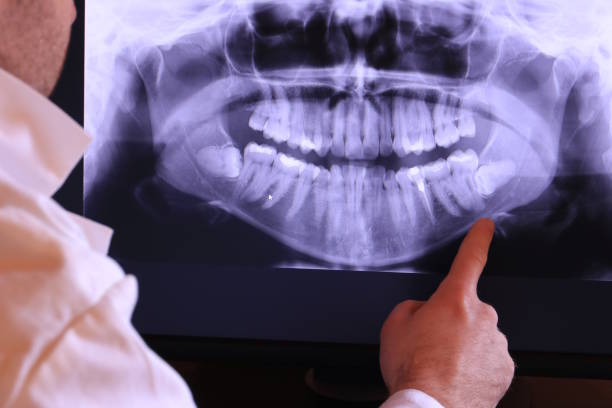 Best Broken or Chipped Tooth Repair in Troy, NC