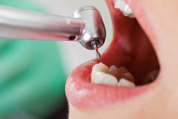 Best Urgent Dental Care for Toothaches in Troy, NC